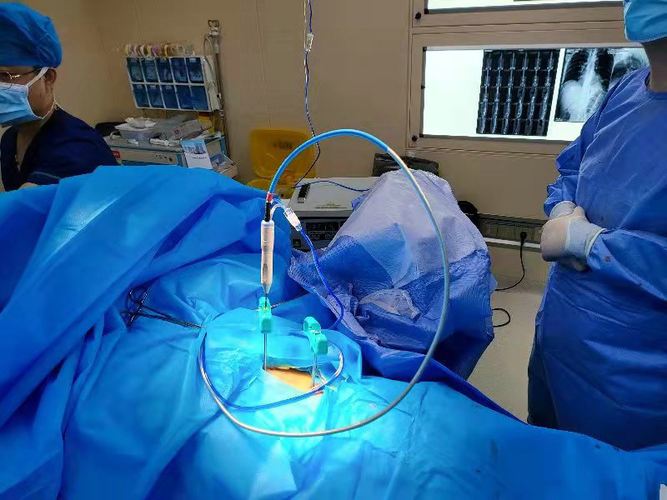 兰大二院骨科成功应用微波消融联合椎体成形技术治疗脊柱转移瘤